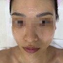 물빛스킨케어 | 물빛스킨케어 광주 주월동 피부관리 스킨부스터 후기