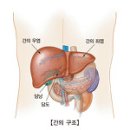 간세포성 암종 (Hepatocellular Carcinoma) 이미지