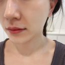 [뽈뽈리뷰]스킨올 에스테틱 - 서면피부관리 업모드 리프팅 후기