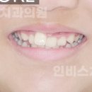 인비스치과의원 이미지