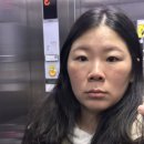 975 | 압구정 루나의원 루비레이저 975방 후기: 1일차