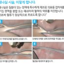 군산한솔마취통증의학과의원 | 중다리저림, 방치하면 하지정맥류로 이어질 수 있습니다! (feat. 군산하지정맥류, 효자동우주통증의학과)