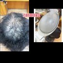 잦은 염색으로 상한 머리+빈약해진 숱, 손상모 탈모 동시 해결 케어법 난리 난 이유 이미지