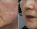 청담이엘피부과의원 이미지