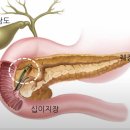 췌장암(간 전이) 4기 환자의 투병 과정 ​ 이미지