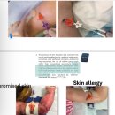 양방언전 「양방언 Evolution 2021」 | (시리즈 8화) INS 2025 Securing Central Venous Access Devices 중심정맥관 고정