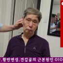 이명(耳鳴)은 녹내장이나 황반변성의 치료에 장애물이 된다. 이미지