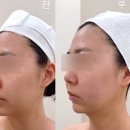 양산 | 양산 덕계 피부관리 윤곽관리 맛집 라미엘피부관리&amp;왁싱 양산점 후기