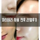 아스테리