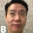 신림역피부관리] 다드림 피부연구소 :: 여드름,예민피부 전문