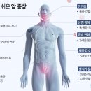 꼭 알아야 할 아홉 가지 암 증상 이미지