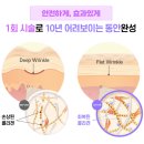 유투성형외과의원 | 강남 팔자주름, 입가주름 - 자가진피재생술 후기