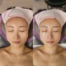 용민로 | [의정부 피부관리] 더마리에 하이푸 윤곽관리 후기