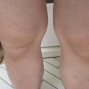 산동튼튼정형외과의원 이미지