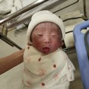 앙즈로여성병원 | 출밍아웃)불당동 앙즈로여성병원 역아 제왕후기38W3D/특실 공원뷰