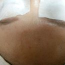 항가령피부연구소