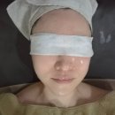 비엔비(BNB) | 운정피부관리샵 <비엔비스파에스테틱 운정점> 피부특수케어 리얼후기✨️