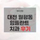 비앤에이치과의원 | 대전시 서구 월평동 치과 임플란트 수술 가격 종류 기간 수술 보험 후기 총정리 19곳