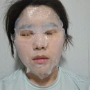 명동피부과 쥬베룩 만족 후기, 스킨부스터 손주사 시술 통증 서비스까지