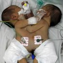 MIDEAST PALESTINIANS GAZA STRIP TWIN GIRLS 이미지