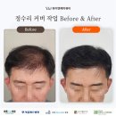 두피문신 학원 와이앤제이뷰티 초보도 가능한 창업 교육 후기