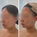 라피움 에스테틱 이미지