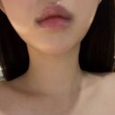 디자인핏 | 부산 남천동 에스테틱 추천｜핏톡스 디자인 관리로 이중턱·팔자라인 관리 후기