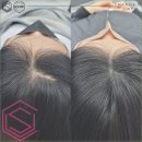 체인지유 | 대전두피 체인지유: 탈모 솔루션으로 새로운 나를 만나다