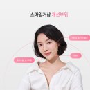 마리오네트 주름 수술 한달차 변화