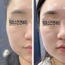 방배천로16길 5 | 이수 피부관리 추천 다운타임 없는 키미스킨앤뷰티 페이스핏톡스 후기