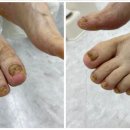 레푸스 망우점 이미지