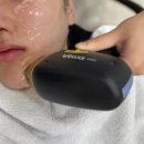 수원 인계동 피부과 세모아의원 V슬림핏레이저 후기