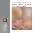 엔에스사우나 | 🔥민감 피부도 OK! 기미부터 모공까지! 엑스터 레이저