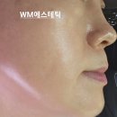 더블유엠 네이버블로그