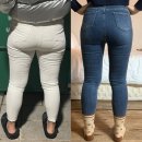 멍스타일 | 허벅지 람스 후기 11주차, -8kg 몸무게·멍·통증 허벅지 지방분해주사 솔직 기록