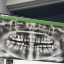 죽파치과 이미지