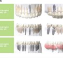 (주)덴티움 이미지