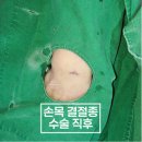 분당서울정형외과 네이버블로그