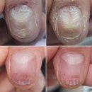 압구정 네일아트 | 강남 압구정 네일아트 젤네일 손톱 손상 관리 후기