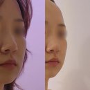 하계동거리 | 노원 에스테틱 &#39;사심뷰티에스테틱&#39; 땅꽁형 얼굴 리프팅 솔직후기 하계동피부관리