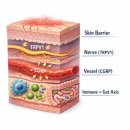 [공지] 주사피부염(rosacea) 홍조 원인 치료 — 왜 열감은 줄고 붉은기는 남는가 핵심 총정리 (치료환자...