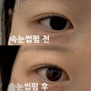 아그네스뷰티 | [인계동 속눈썹펌 추천] ‘디아엘뷰티 수원인계점‘ 바짝컬/한관종 아그네스 후 속눈썹펌