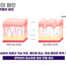 이노셀