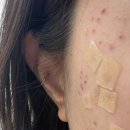 한내로100번길 | 청라잡티제거 디어브로우 인천잡티관리 잘하는 곳 후기