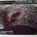 최광순한의원 이미지