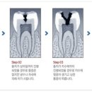 휴먼치과 이미지