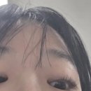 닥터봄의원 | 닥터아이씨엘안과의원 렌즈삽입술 후기(4) 한달+a 경과후기