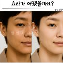 백옥 | 백옥주사 글루타치온 솔직후기! 효과 및 가격