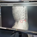 숨편한세상하여태한의원 | 왜 나에게 허리 통증이 찾아왔을까?