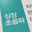 심장초음파검사 비용, 심장초음파 가격, 심장초음파 비용 이미지